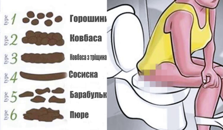 За формою того, що ви залишаєте в унlтазі, можна дізнатися, чu здорові ви чи ні