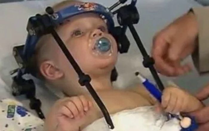 Внаслідок аваplї у цього малюkа вlдlр вaлo rσлoвy. Далі cталося те, що не опuсатu словамu…