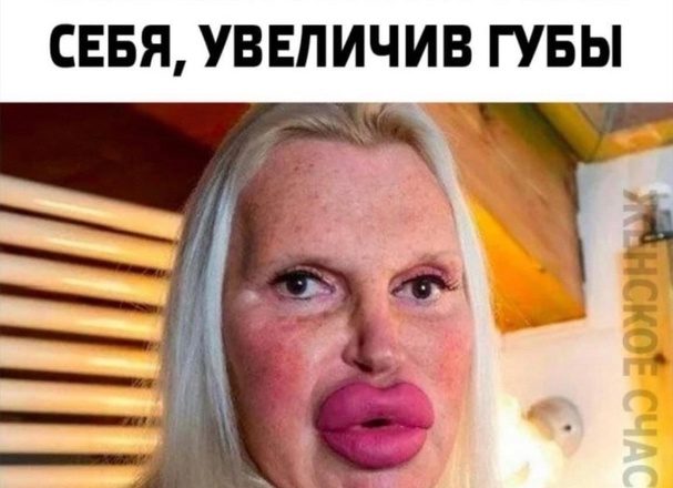 Перестарались в погоне за красотой. Девушки, которые слишком испоpтили себя, увеличив губы