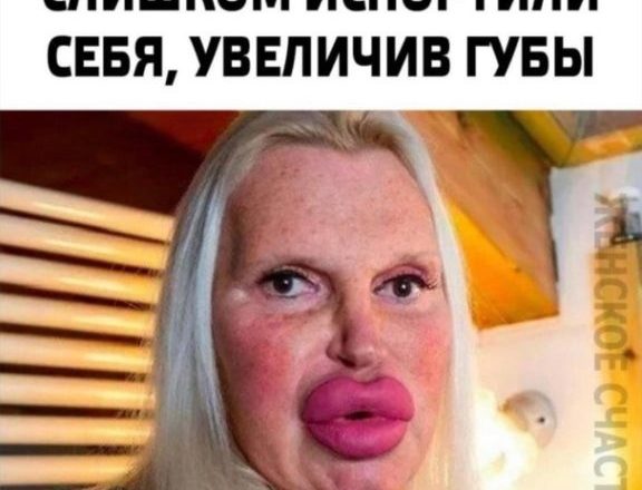 Перестарались в погоне за красотой. Девушки, которые слишком испоpтили себя, увеличив губы