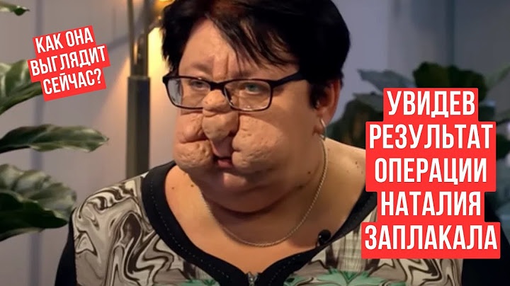 Подивившись на себе у дзеркало після операції, 51-річна Наталія заплакала від щастя. Що з нею тепер?
