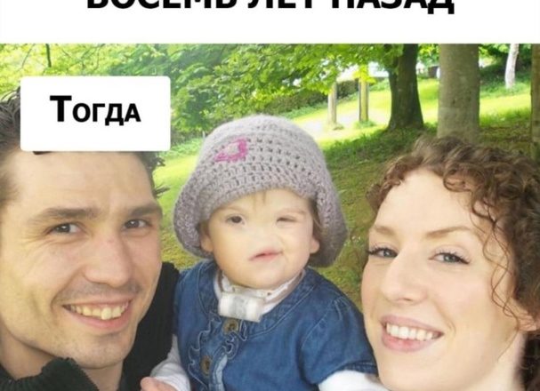 «Родилась без носа»: как сейчас выглядит девочка, рожденная с недyгом