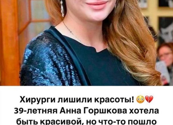 Хирурги лишили красоты. В сети появились фото 39-летней Анны Горшковой после неудачной пластики