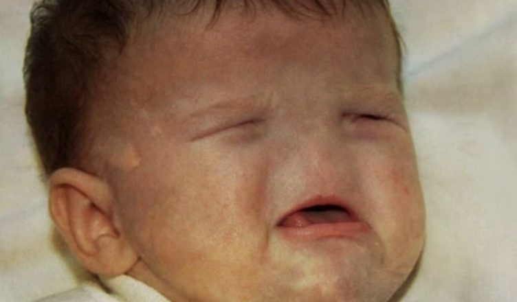 Він народився без ноги, рота та носа. Ось яким він став через 9 років! Це треба бачити!