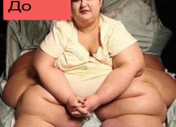 Самая полная женщина в мире похудела на 200 кг