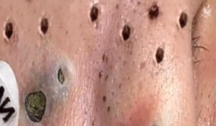 Изменения на лице, указывающие на серьезные проблемы со здоровьем