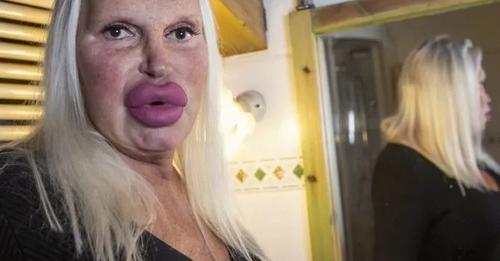Ця жінка витратила 75000 $ на «ідеальне обличчя». Фотографії «до» просто необхідно побачити