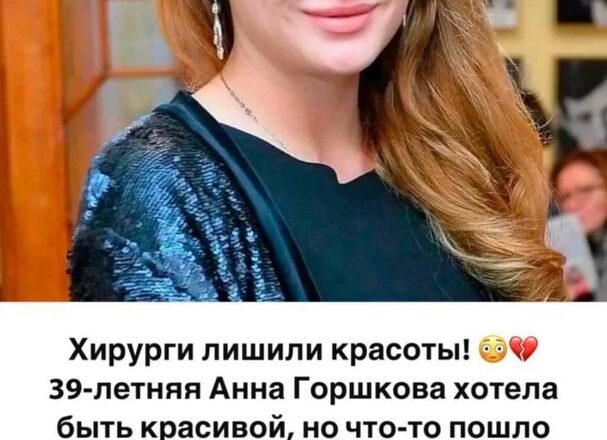 Хирурги лишили красоты. В сети появились фото 39-летней Анны Горшковой после неудачной пластики