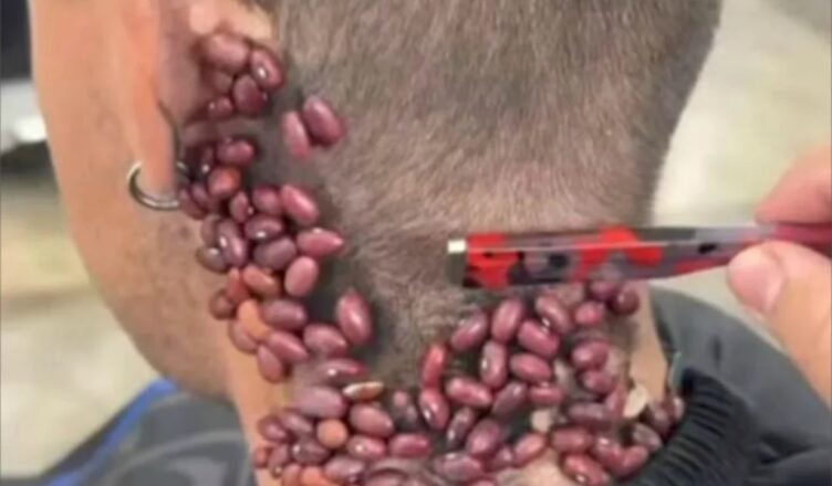 СЕМЬ ВЕЩЕЙ, КОТОРЫЕ ЗАКРЫВАЮТ ПОРЫ И ВЫЗЫВАЮТ АКНЕ