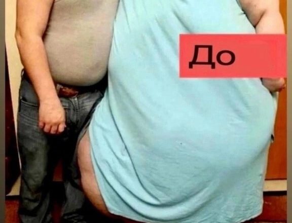 Втратила 232 кг, нирку та хлопця: сумна історія однієї з найтовстіших жінок у світі