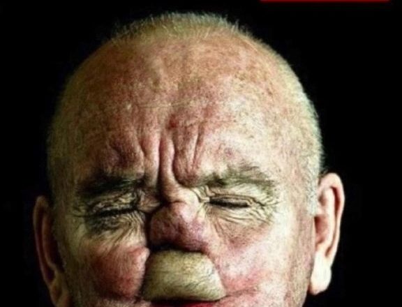 Делаются фотографии людей, проходящих процесс реконструкции лица, чтобы создать серию убедительных изображений…