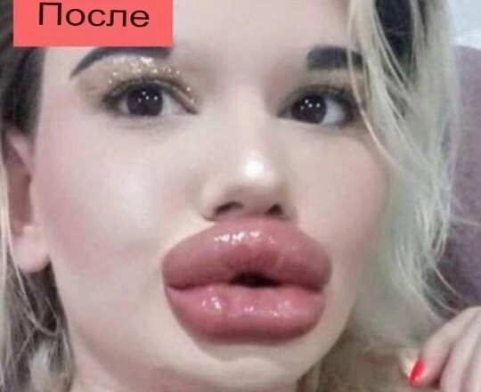 Из-за хирургов она потеряла всю свою красоту, и вот как она выглядела раньше…