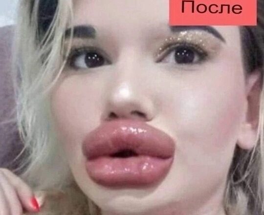 Из-за хирургов она потеряла всю свою красоту, и вот как она выглядела раньше…