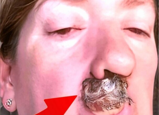СЕРЬЕЗНЫЕ заболевания диагностируются по сигналам кожи!