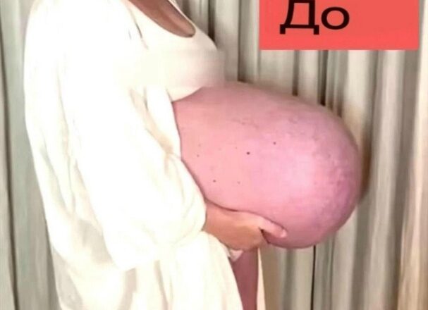 Гигантская шишка МАМЫ