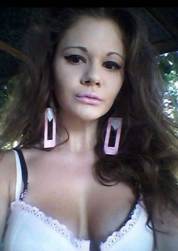 Человек с самыми большими губами на планете!