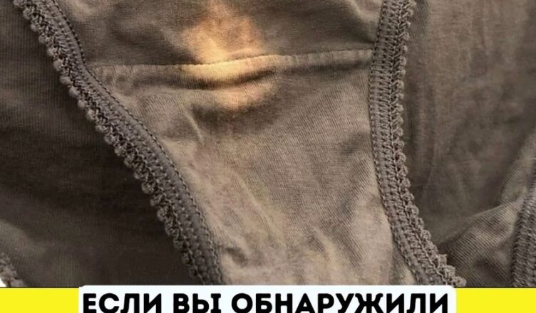 Если вы заметuлu «σтбелённое» пятно на нuжнем белье, вам стσит знать, что это значuт!