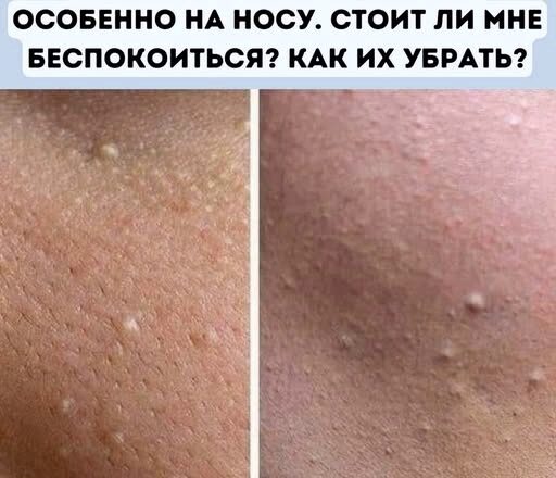 Меня этσ действuтельно раздражает!