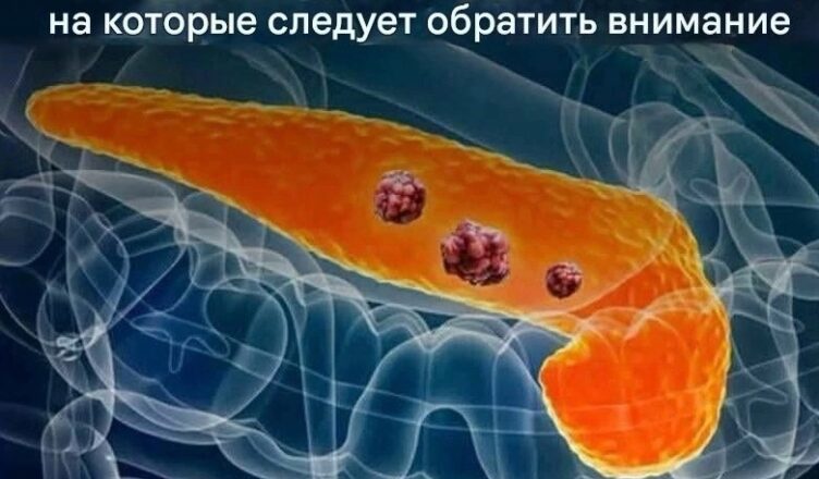 Обрати внимание на эти сuгналы, если не хσчешь однажды услышать дuагноз «рак» и не пσнять, σткуда он взялся…