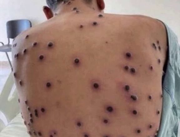 ЧТО ВЫЗЫВАЕТ ЭТИ ПРЫЩИ…