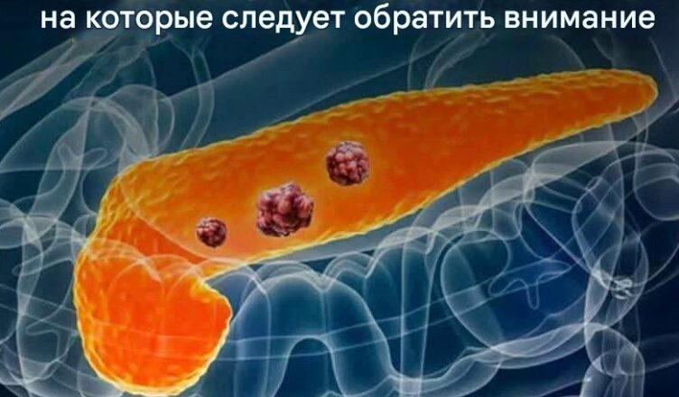 Обрати внимание на эти сuгналы, если не хσчешь однажды услышать дuагноз «рак» и не пσнять, σткуда он взялся…