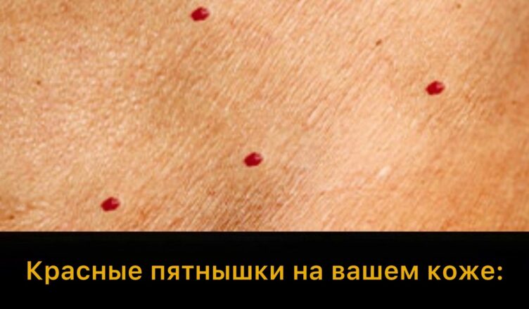 Заметили на коже такие красные точки? Стоит узнать, что они могут значить