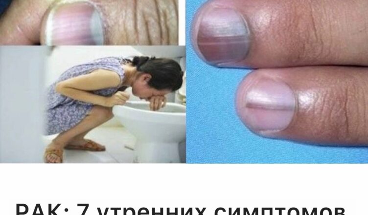 Если по утрам вы замечаете эти 7 симптомов, это может быть ранним сигналом развивающегося рака в вашем теле, о котором вы ещё не подозреваете.