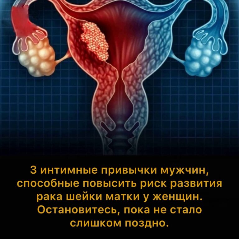 Рак Матки Секс Рак Матки Секс