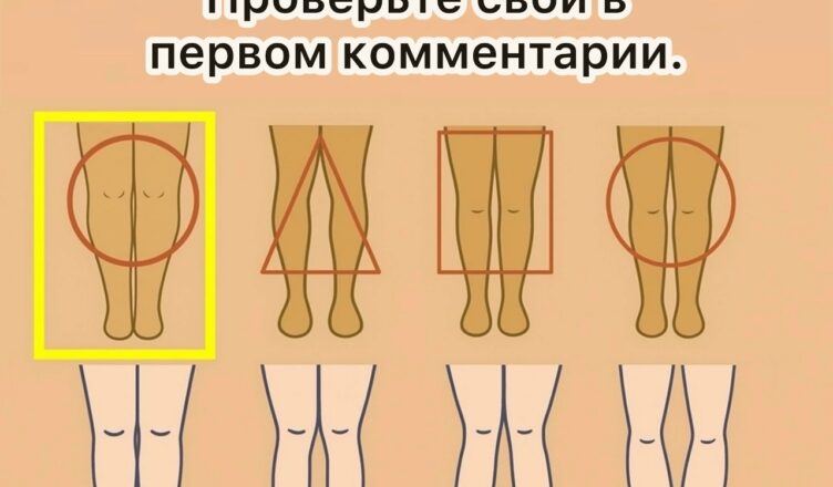 ФОРМА ЖЕНСКИХ НОГ МОЖЕТ МНОГОЕ РАСКРЫТЬ…