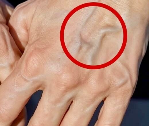 Если на ваших руках заметны вены, это означает, что вы…