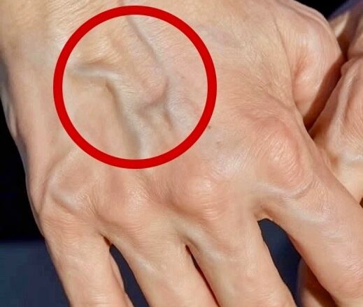 Если на ваших руках заметны вены, это означает, что вы…