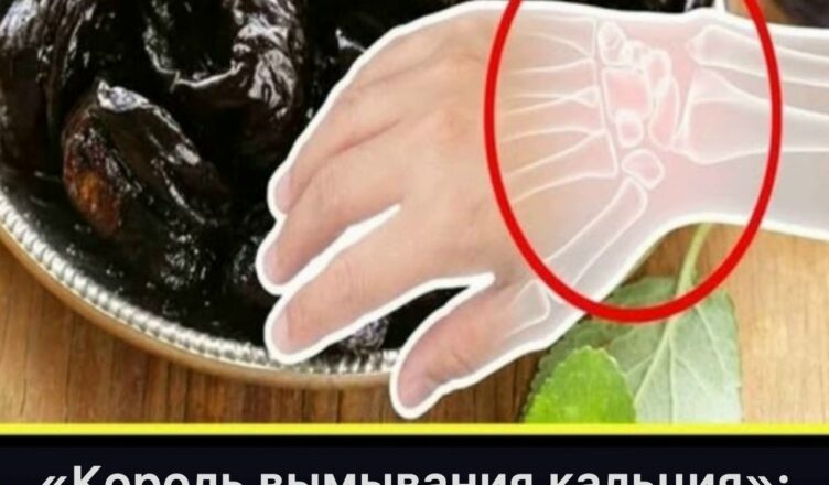 «Король вымывания кальция» — 3 популярных напитка, которые шаг за шагом ослабляют ваши кости.