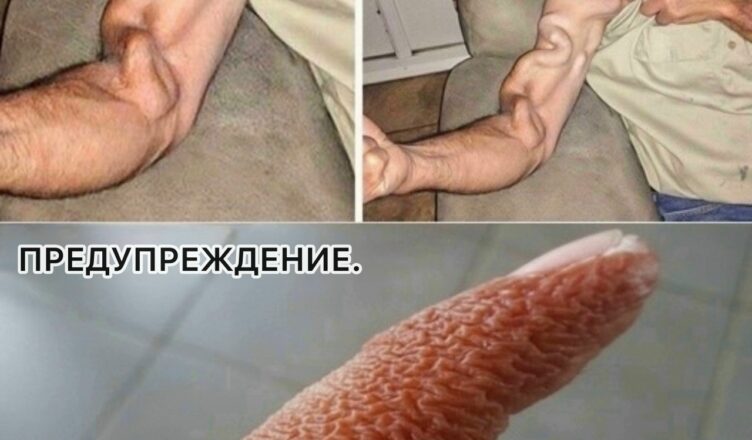 Мужчина потянулся и внезапно ощутил резкую боль в руке, это был ра…
